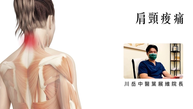 肩頸痠痛
