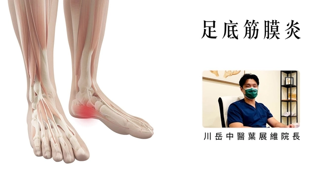 足底筋膜炎
